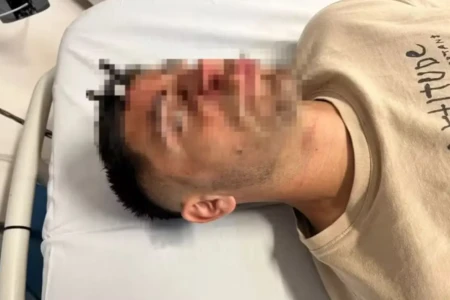 Jogador fica com chave de carro cravada na testa após briga em estádio (Foto: Reprodução)