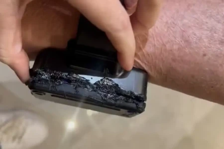 Polícia identificou presença de ferro na área queimada PF conclui que Bolsonaro tentou abrir tornozeleira com 'fonte de calor'