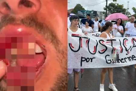 Discussão política em bar terminou em agressão Morador de Goiandira denuncia agressão de PMs fica quatro dias internado e passa por cirurgia