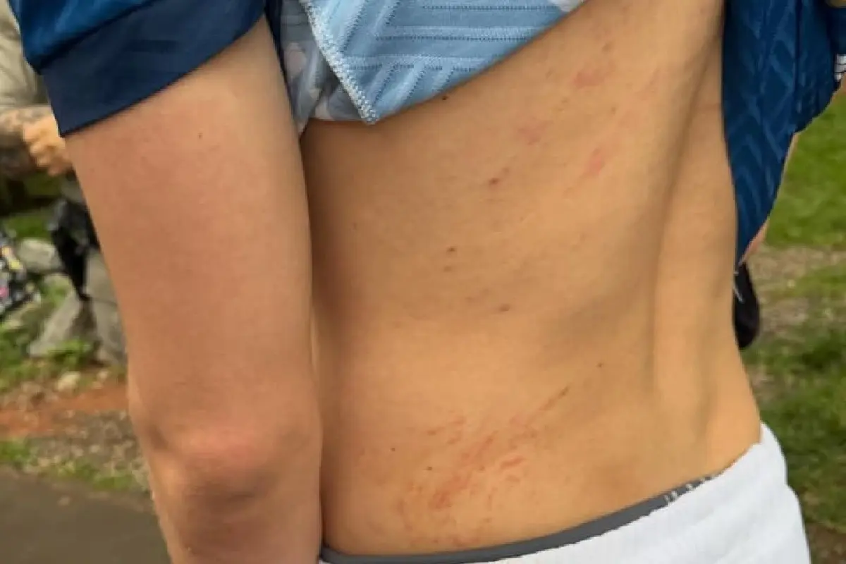 camtor x ferido x assalto