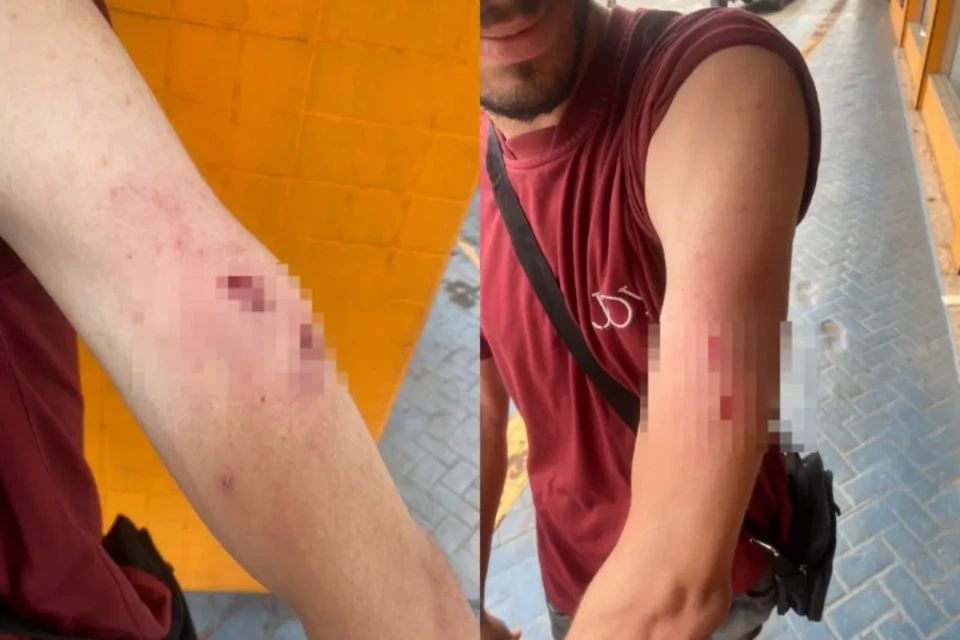 Imagem dos ferimentos