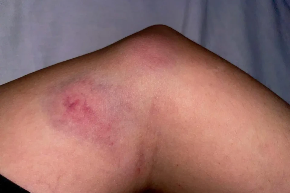 Fotos cedidas pela vítima