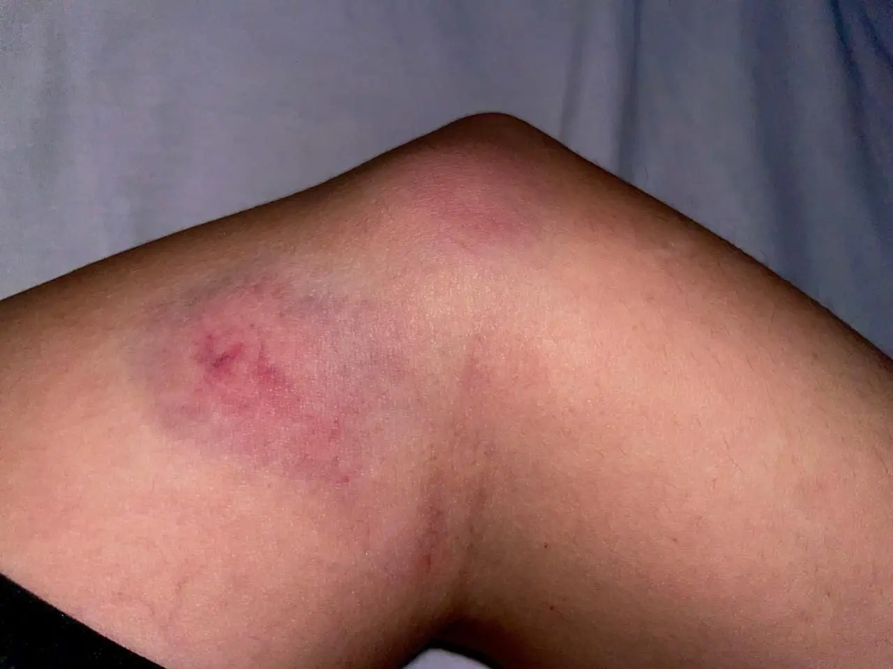 Fotos cedidas pela vítima