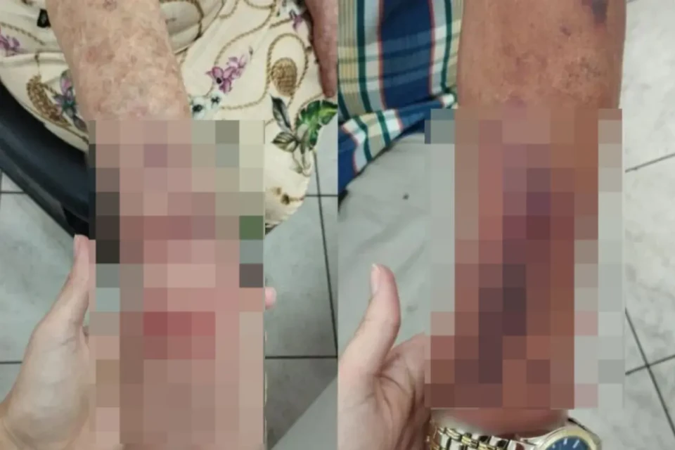 Idosa é agredida com tamanco durante briga entre moradores em condomínio de Aparecida pedir que vizinha diminuísse o volume do som
