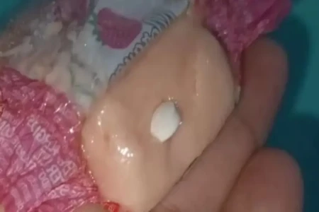 Bala de Papai Noel leva criança ao hospital em Minas Gerais