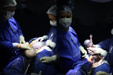 Imagem do nascimento dos trigêmeos