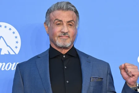 sylvester-stallone-hair-transplant-1