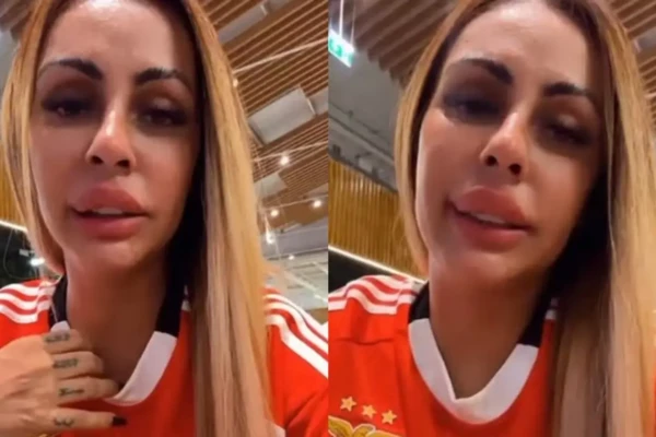 Imagens fortes: tatuagem quase leva ex-Miss Bumbum à amputação da perna; veja foto Miss Bumbum Débora Dunhill cicatrização