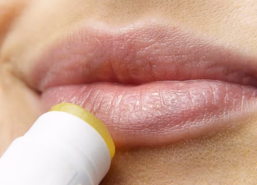 Vírus da herpes já infectavam humanos há mais de 2.000 anos, indica DNA antigo