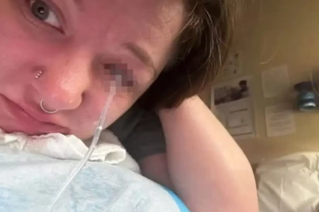 Mulher fica com sequela permanente num olho após acidente durante tarefa doméstica riscos de produtos químicos no rosto água sanitária