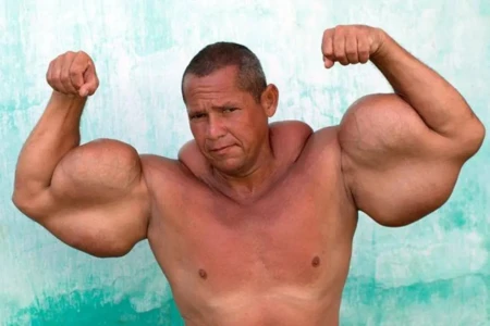 Arlindo de Souza, conhecido como “Popeye Brasileiro”, morre aos 55 anos Arlindo ganhou notoriedade pelo tamanho incomum dos bíceps