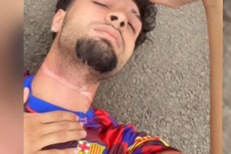 PESCOÇO X MOTOCICLISTA