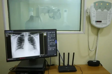 Nove de 11 unidades de saúde de Goiânia estão sem serviço de Raio-X