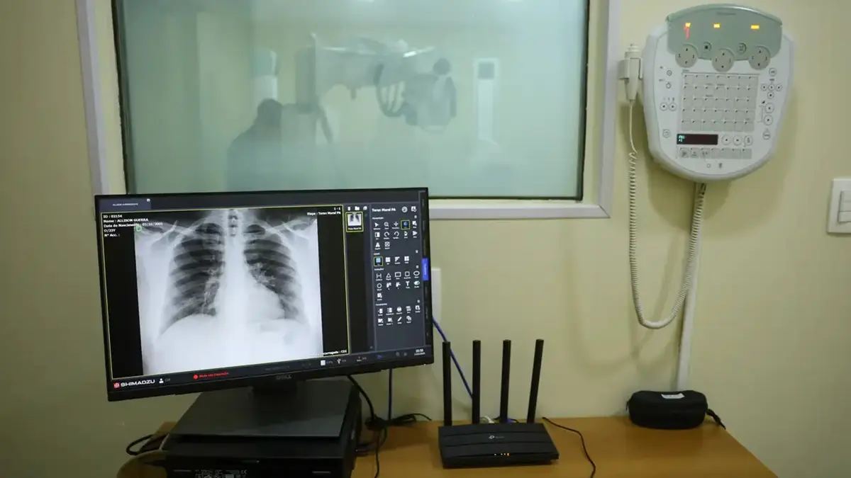 Nove de 11 unidades de saúde de Goiânia estão sem serviço de Raio-X