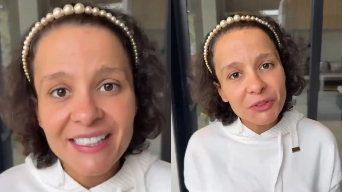 Maiara relata queda de cabelo e fala sobre diagnóstico de alopecia androgenética