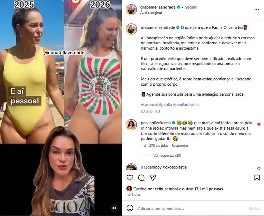image Paolla Oliveira rebate médica após comentário polêmico sobre sua região íntima; veja fotos