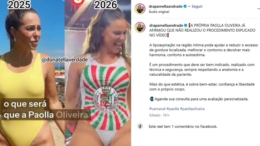 image Paolla Oliveira rebate médica após comentário polêmico sobre sua região íntima; veja fotos