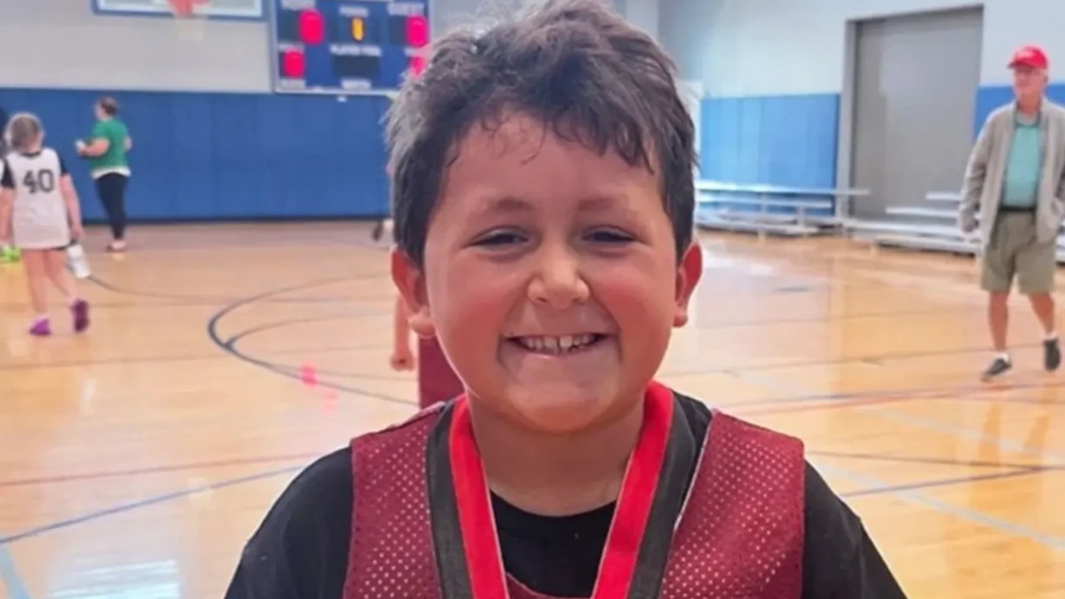 Menino fica com o rosto deformado após participar de desafio no TikTok; veja foto lado direito do rosto dele estava derretendo, contou a mãe