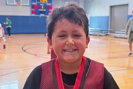 Menino fica com o rosto deformado após participar de desafio no TikTok; veja foto lado direito do rosto dele estava derretendo, contou a mãe