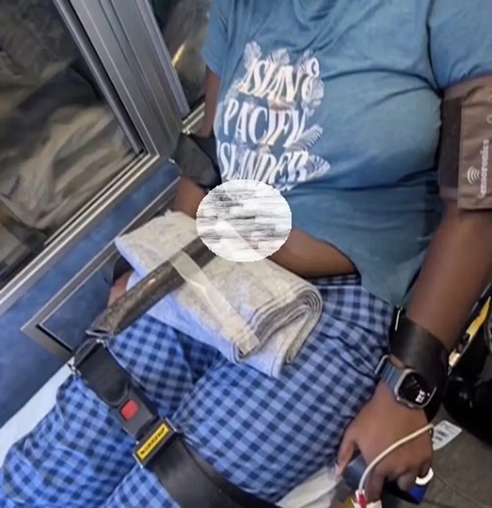 image Imagens fortes: Jovem sobrevive após acidente deixar cabo de metal cravado na barriga