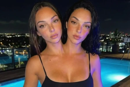 Valeria e Camila conquistaram fãs no mundo todo Com foto de biquíni, “gêmeas siamesas” ultrapassam 331 mil seguidores
