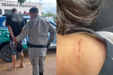 Motorista ficou com marcas no pescoço devido a agressão - (Foto: divulgação/PM)