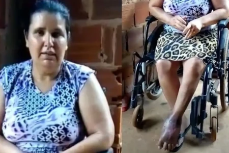 Paciente pede ajuda para amputar a perna