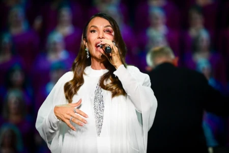Ivete Sangalo anuncia cirurgia no rosto após queda e desmaio