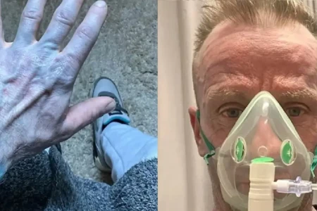 Enfermeiras ficaram assustadas com a cor do paciente Homem acorda com o corpo azul, corre para hospital e se surpreende com diagnóstico