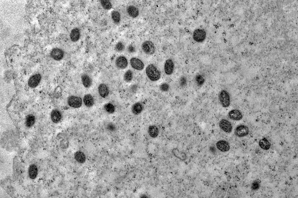 Brasil registra 136 casos de mpox em 2026; cinco novos estados notificam a doença
