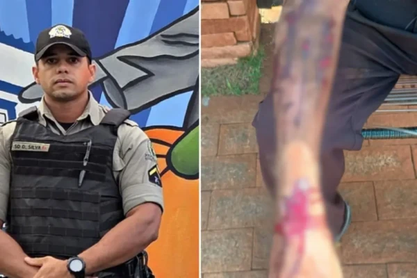 Imagem mostra policial envolvido na ação e braço do idoso machucado