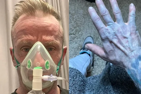 Enfermeiras ficaram assustadas com a cor do paciente Homem acorda com o corpo azul, corre para hospital e se surpreende com diagnóstico