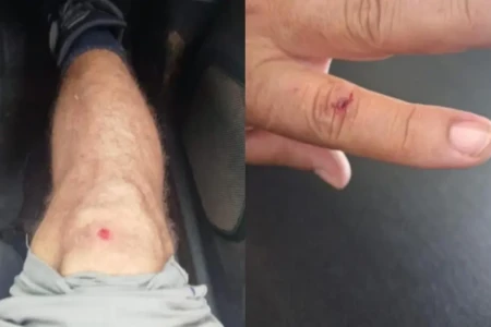 PM teve ferimentos na mão e no joelho - (Foto: reprodução/PM)