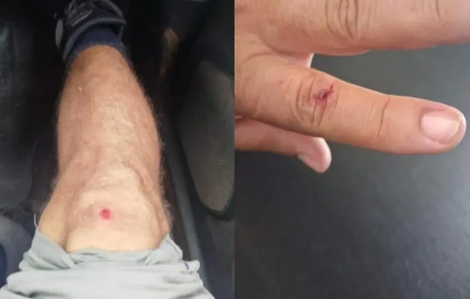 PM teve ferimentos na mão e no joelho - (Foto: reprodução/PM)