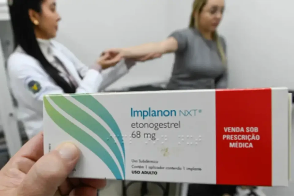 Mutirão oferece DIU gratuito em Goiânia e Aparecida 3 implanon Mutirão oferece DIU gratuito em Goiânia e Aparecida