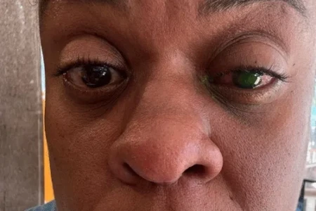 Cacau-Protasio-perde-visao-apos-uso-de-pomada-e-as0036379601202603251304-7