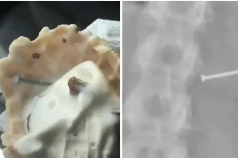 image Mulher receberá indenização de R$ 73 milhões por ficar infértil após tomar sorvete