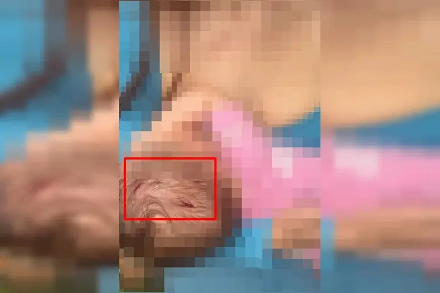 Imagem dos ferimentos