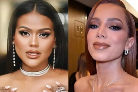 Camila Loures elimina veia da testa; Anitta já passou pelo procedimento em Goiânia Tratamento atua de dentro para fora e exige cuidados no pós