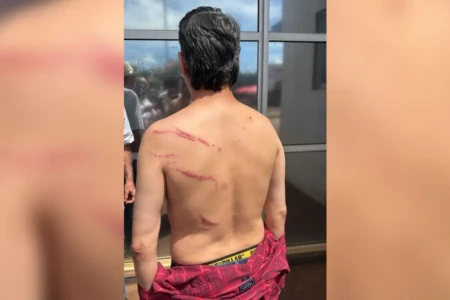 Preso em ato do MST em Goiás, vereador depõe à polícia, é liberado e faz exame de corpo de delito