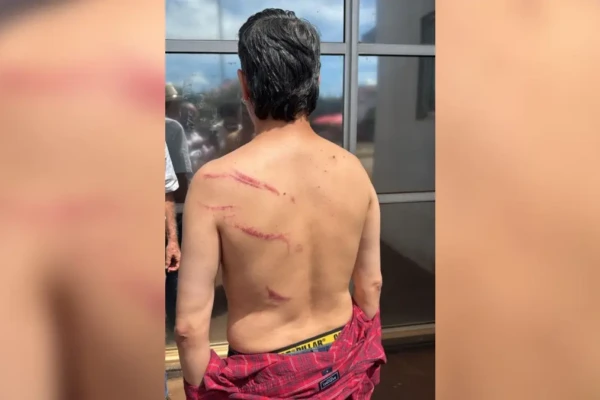 Preso em ato do MST em Goiás, vereador depõe à polícia, é liberado e faz exame de corpo de delito