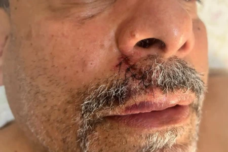 Geso Oliveira lesões Vila x Operário acusado de racismo