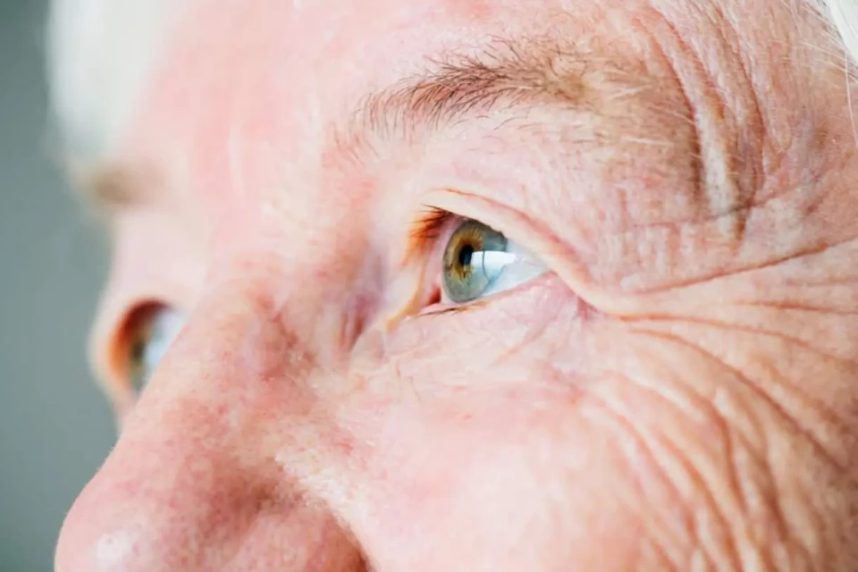 Doença lidera as causas de cegueira irreversível no mundo Risco de glaucoma é maior em pessoas com mais de 40 anos; saiba mais sobre a doença