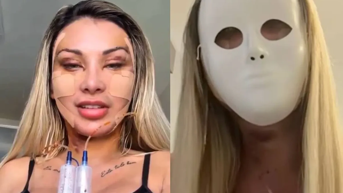 Ex-Igreja Universal deseja voltar aos 23 anos vídeo Andressa Urach gasta R$ 100 mil em cirurgias pláticas: 