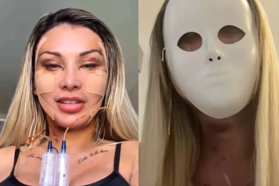 Ex-Igreja Universal deseja voltar aos 23 anos vídeo Andressa Urach gasta R$ 100 mil em cirurgias plásticas: "rosto novo após o divórcio"
