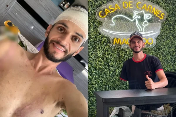 Açougueiro de Anápolis supera limitações após perder braço em acidente