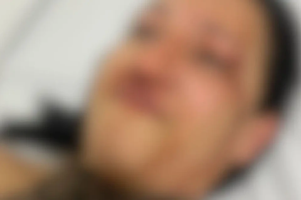 Mulher denuncia policial militar de agressão e ameaça em Cachoeira Dourada 