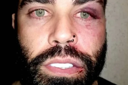 Justiça absolve cantor acusado de furto e mantém indenização por agressões em transportadora