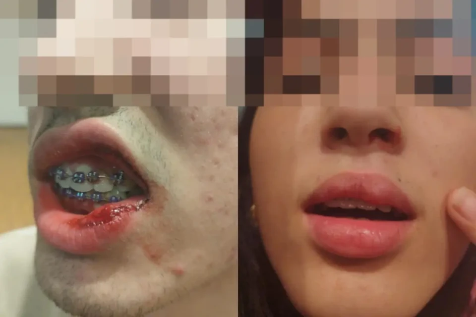 adolescentes x agressão x lutador 