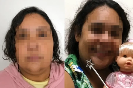 Pequena Amanda chegou a receber Mounjaro Mulher de 37 anos presa por fingir ter 12 já fingiu ser criança em tratamento em Goiás